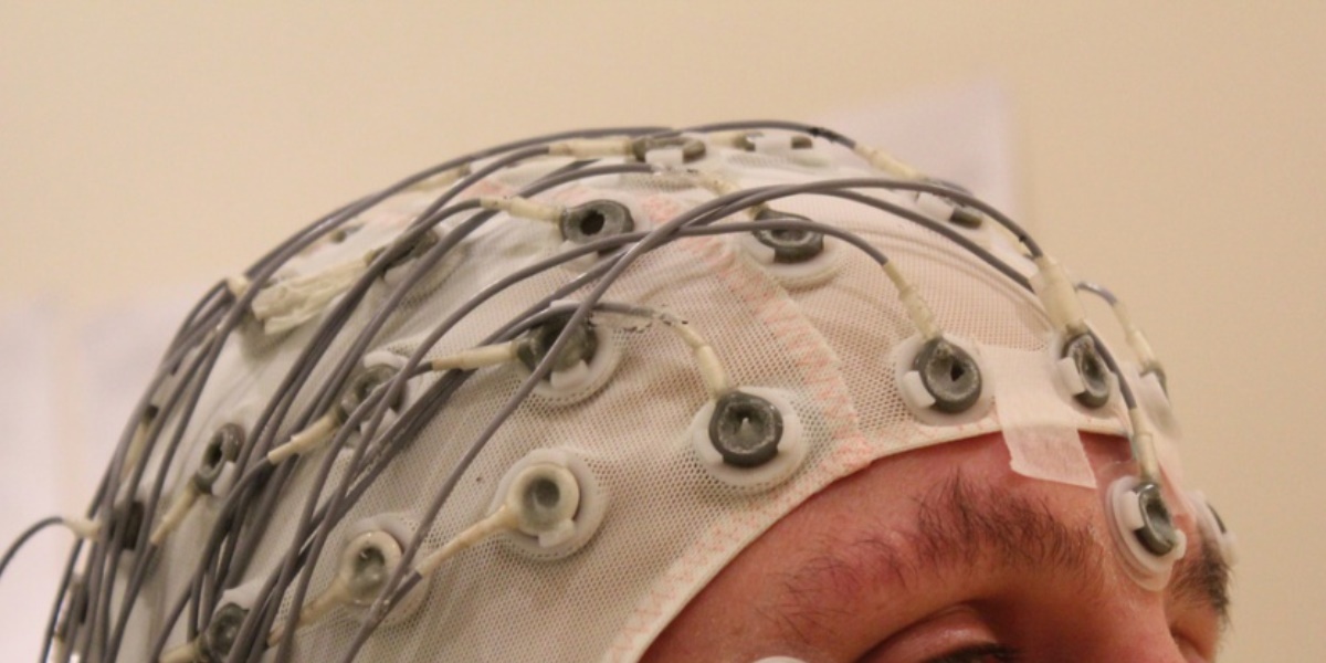 L'elettroencefalogramma quantitativo per l'individuazione di marker precoci AIMA Associazione